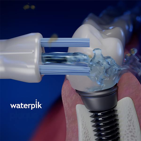 Whitening Plaque Seeker? Tip WPS-2E | Replacement Tips - Image 3